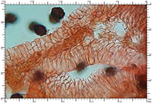 Hymenobgaster melasporus